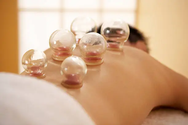 Cupping Therapy at Datta Ashram Pain Relief Center – Natural Healing Through Ancient Therapy